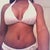 4 wks post op