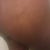 if you look close youl see the small lump