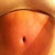 original scar is almost gone!