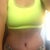 4 weeks post op