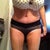 My after picture....4 days post-op!