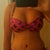 5 weeks postop mommy makeover, lower abdomen still quite abit swollen