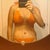 6 weeks post op mommy makeover