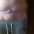 Here's my 5month post op photo...I am seeking a second opinion at this point. My result is being blamed on my weight (which is 9lbs lighter than preop). I am not gaining weight and I am exercising. After expressing concerns to my PS he requires a 21lb weight loss. I'm feeling very discouraged. 10 lbs? ok! 21lbs I will be a skeleton no thanks. I am also concerned because my incision is higher than all of my pants underwear and bathing suits. PS said the scar will magically lower after I reach the unattainable 21lbs. I'm cornered.