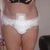 3 days post op, obviously not standing up straight