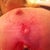 Hoping this will heal with minimal scarring