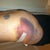 This is the bruise we are worried may be a hematoma. I am going in tomorrow to have it looked at (again)..;
