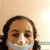 Just after surgery
