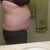 2 weeks pre-op