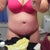 15 days PO, soooo swollen.