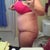 15 days PO, drains are out, swollen!!