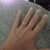 Fat hand, brought back old fat me memories :(  if this happens it's from IV or blood pressure cuff