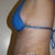 3 weeks post-op side view. I'm still swollen but it's improving every day.