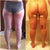 This was how i looked The first week after The lipo, and The before picture I took at home.