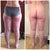 This was about , hmm maybe one month after My lipo, you Can see a little change...