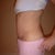 You can see the scar the binder made me