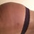 Booty not swollen just sides