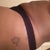 8 Weeks stomach and sides still swollen
