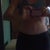 5 weeks post op - swelling down a bit