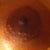 you can barely see the scar at all