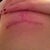 left incision underneath