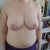 2 months post op