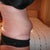 Day 59 8 wk 2 days - bulging, now named my rubber ring look.......looking at my right side