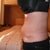 Day 59 8 wk 2 days - bulging, now named my rubber ring look....... looking at my left