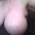 Heavy breast tissue