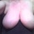 This really shows my auxiliary breast tissue under my arms.