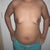 146 lbs. Day before the surgery