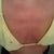 pre op of my boobs before BA