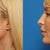 Side profile Doc simulation, I like how he has maintained stronger proportions to match my chin and forehead, this picture also shows subtle jaw sculpting