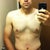 7 days post-op. Swelling started.