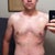 18 days post-op. Swell hell.