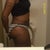 Side View 7 Wks Post Op