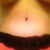 Under belly button looks swollen... What
 do you think??...13 days post op inc sx day
