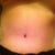 Same pic but looks swollen..13 days post op