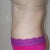 3 weeks. not much change. still have a seroma below my belly button and some general swelling. not too bad though