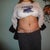 3 days post-op.