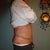 3 days post-op.