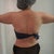 Photo1: My arms before vaser. From this photo please notice my waist (i had more curve before) i feel like i have a tumor under my waist. The photo didn't clear but i know that the fat tumor is gone.