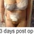 front view, before before to 19 days postop