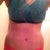 17 DPO. I don't feel as fat/thick from this angle lol :) and my incision is hidden nicely. Also, if MTV ever does a "True Life: I'm Obsessed with my Belly Button," be sure to look out for yours truly...how cute is it?!?!