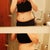 1 week post-op. Very swollen, looks like I've gained weight! But I know it will go down and I'll start seeing some awesome results soon :)