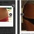Pre-op and 1 day post op