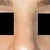 I hate how bulky and asymmetircal my nose looks!