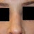 You can sort of see the indent on my nose where I can feel the gap.