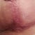 healing.... yay