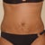 front4 days post op